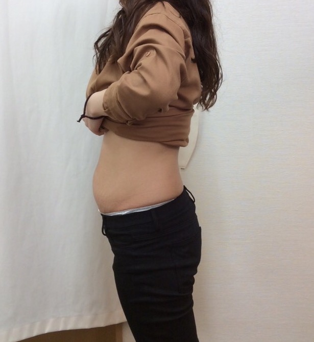 産後、体重も体型も元に戻らず悩んでいました。：BEFORE画像