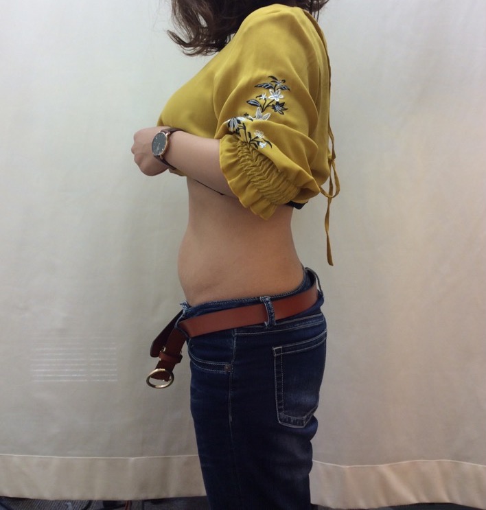産後、体重も体型も元に戻らず悩んでいました。：AFTER画像